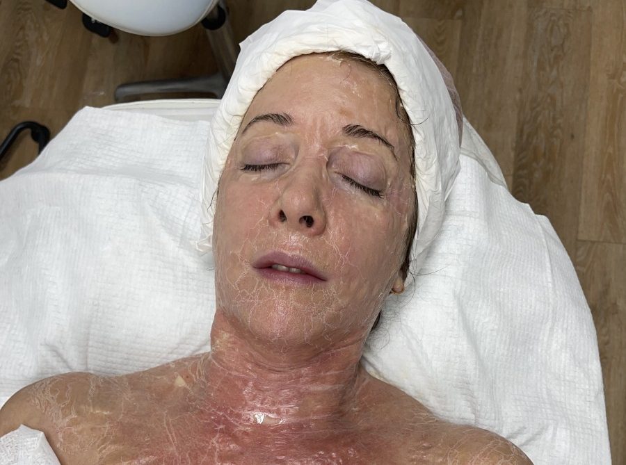 DMK - Enzyme Oxygen Therapy Facial